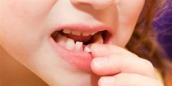 اطلاعاتی که تا به حال در مورد دندان شیری کودکان نمی دانستید
